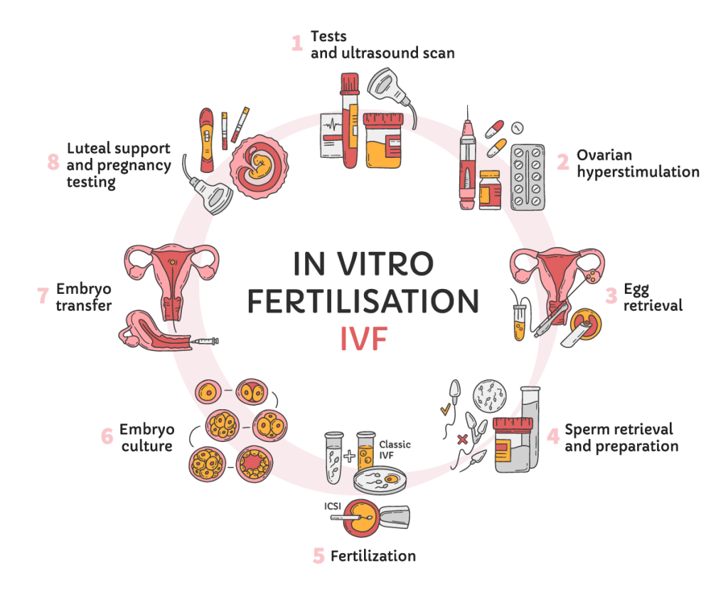 IVF process step by step