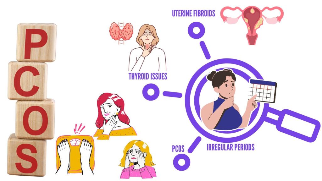 Medical illustration of PCOS, thyroid disorders, and uterine fibroids causing irregular periods