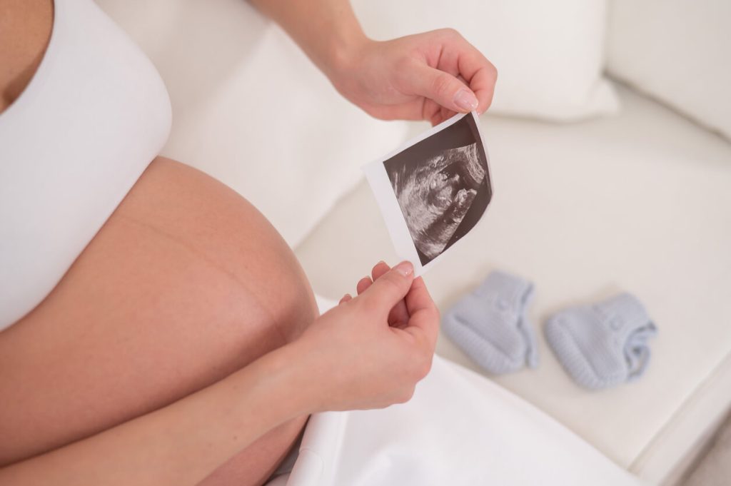 Ultrasound of baby in second trimester